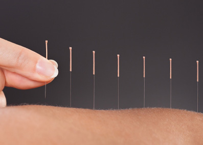 Integrative medicine for holistic well-being in gynecology