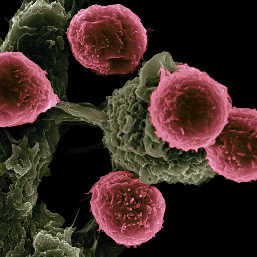 Tumour-agnostic gene fusions can occur in different types of cancer. The same type of gene 
Tumoragnostische Genfusionen können bei verschiedenen Krebsarten auftreten. So kann beispielsweise dieselbe Genfusion sowohl bei Darmkrebs als auch bei Brustkrebs vorkommen und möglicherweise mit derselben zielgerichteten Therapie behandelt werden.